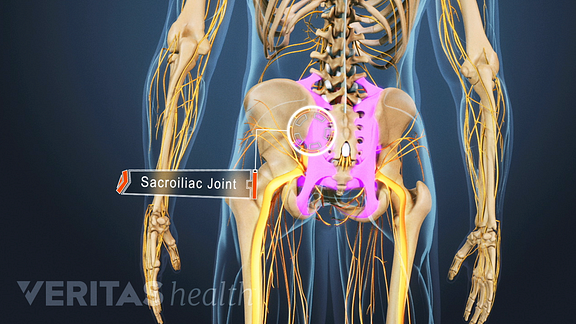 Types Of Arthritis That Cause Sacroiliac Joint Pain