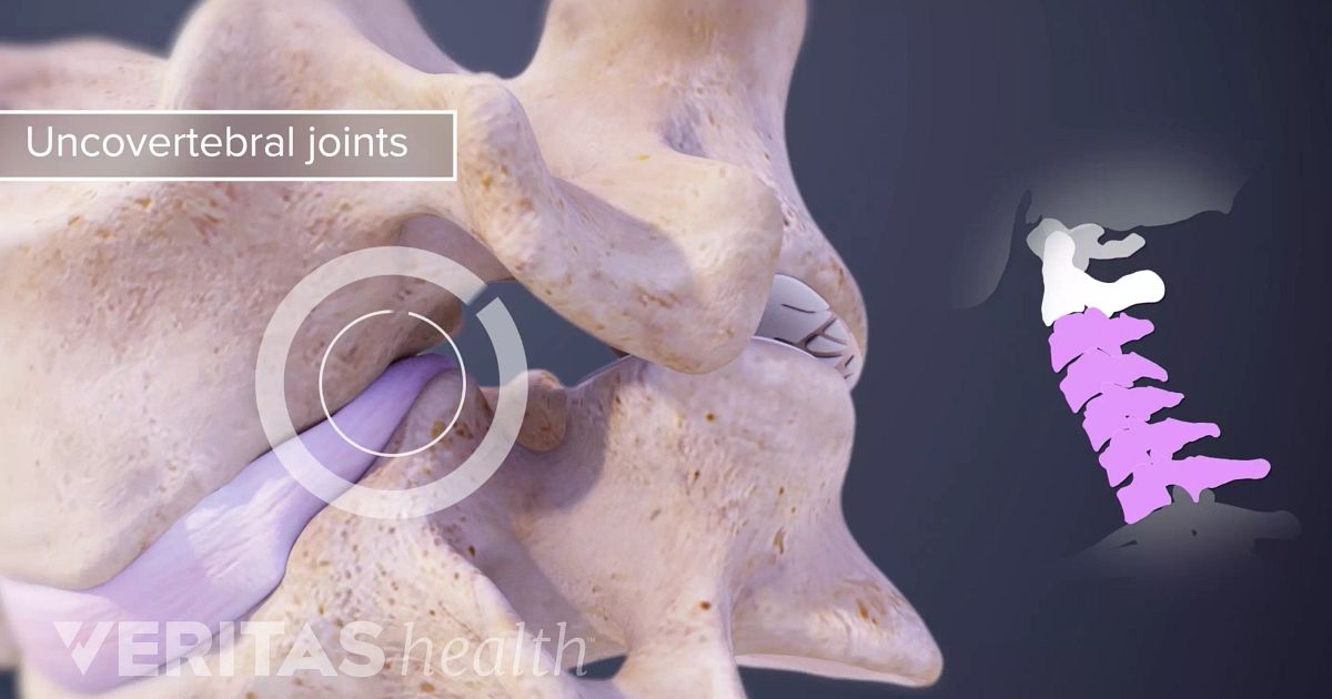 Uncovertebral Joint Definition | Back Pain and Neck Pain Medical Glossary