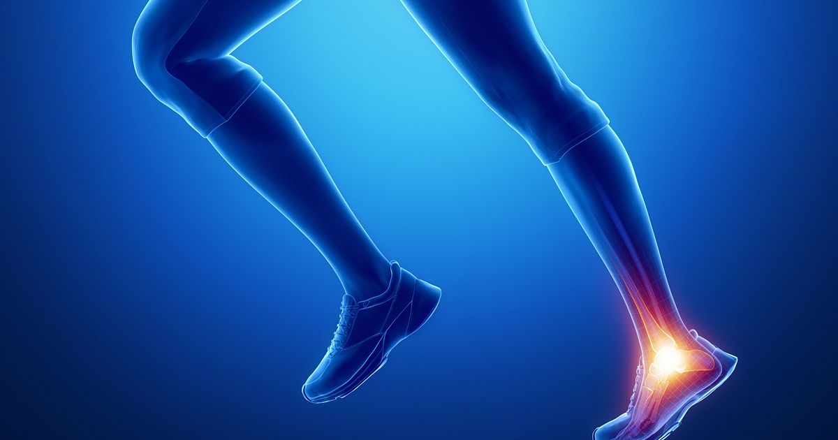 What Is the Difference Between Tendonitis, Tendinosis, and Tendinopathy?