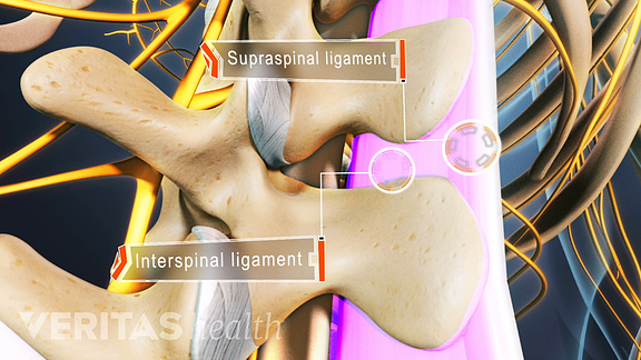 A close up view of an illustrated spine with the supraspinal and intraspinal ligaments labeled