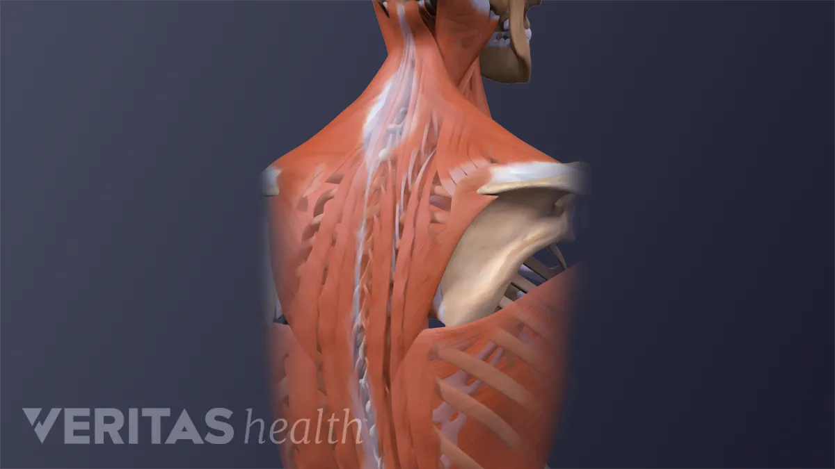 Why Upper Back Stiffness Could Be the Root Cause of Your Shoulder