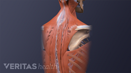 upper chest discomfort radiates to upper back pain upper chest discomfort radiates to upper back pain