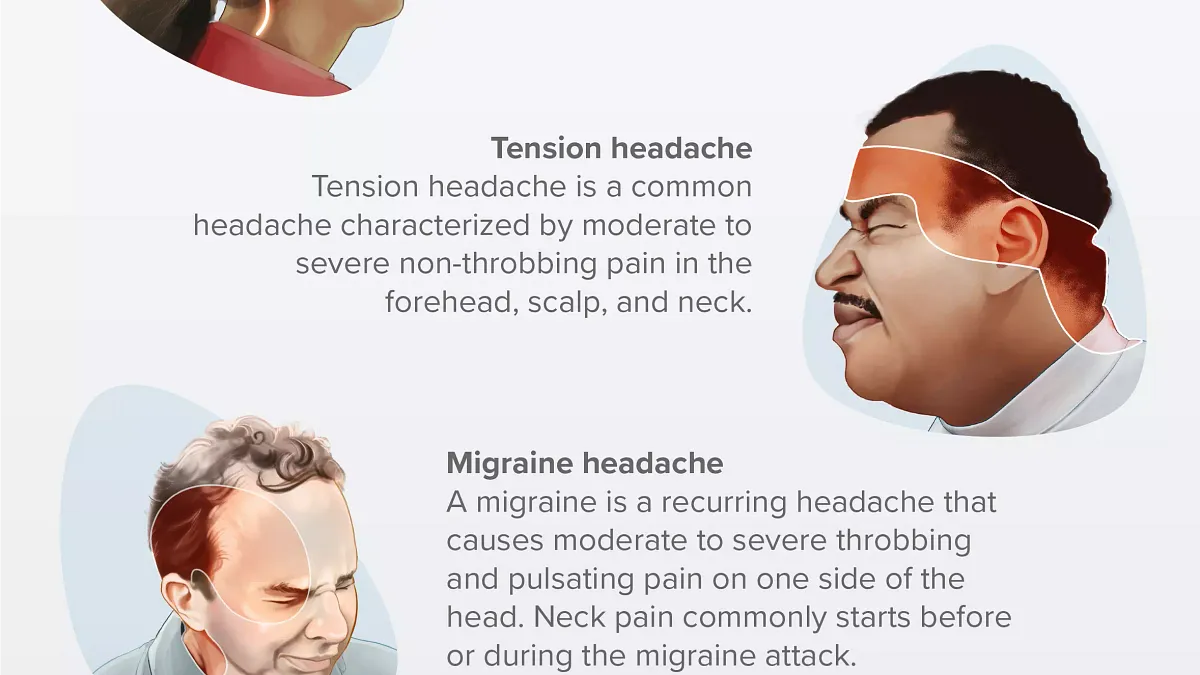 severe migraine headaches