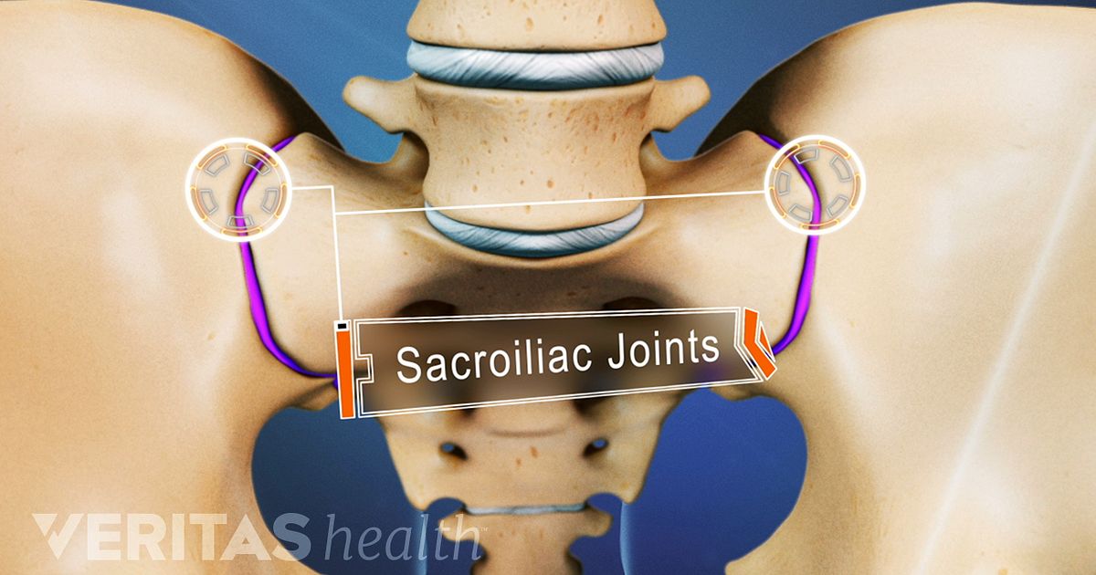 Sacroiliac Joint Anatomy