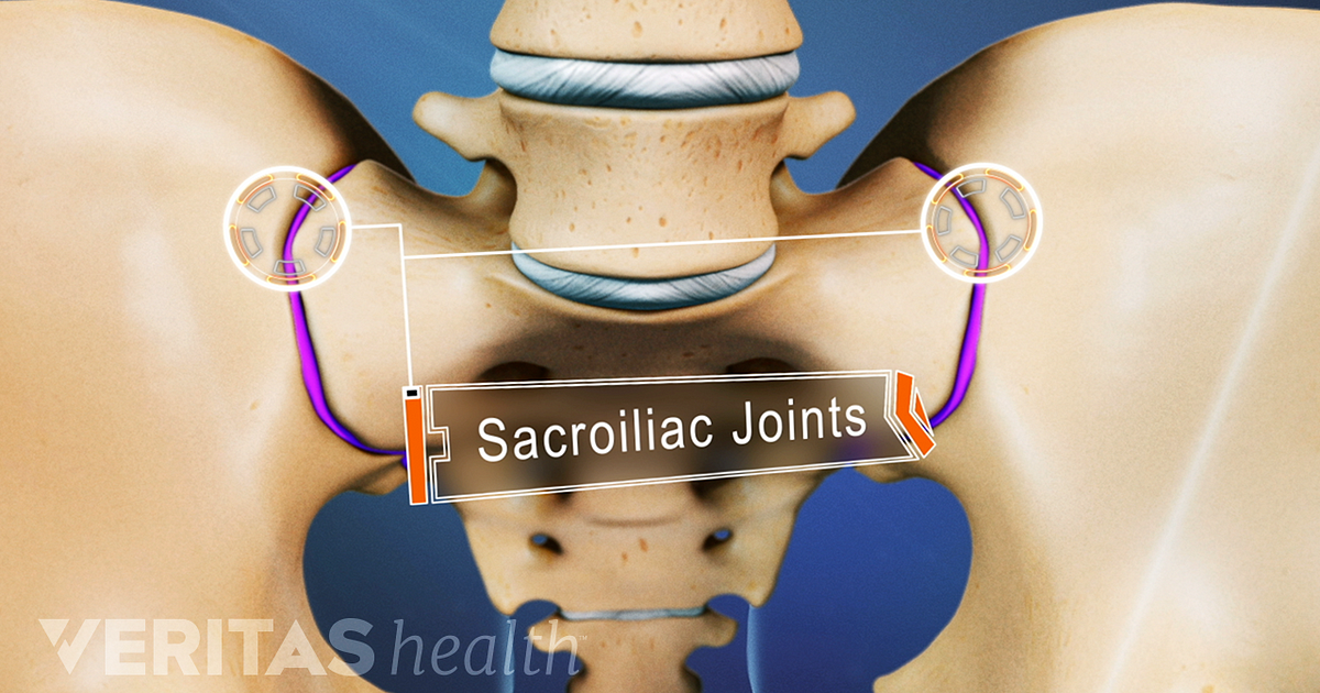 treatment-options-for-sacroiliac-joint-dysfunction