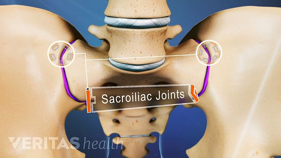 Sacroiliac Joint Pain