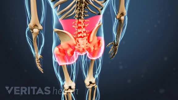 A Visual Guide to Hip Osteoarthritis
Osteoarthritis Hip Pain