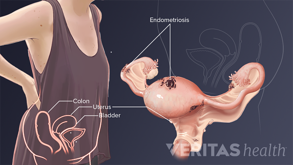 Lower Left Back Pain from Internal Organs