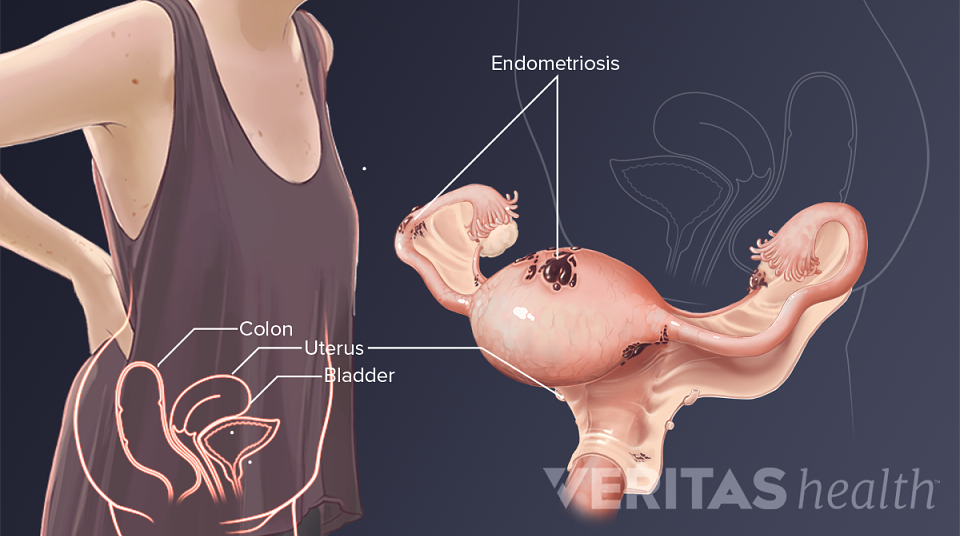 Slideshow: 7 Ways Internal Organs Can Cause Lower Back Pain Slideshow