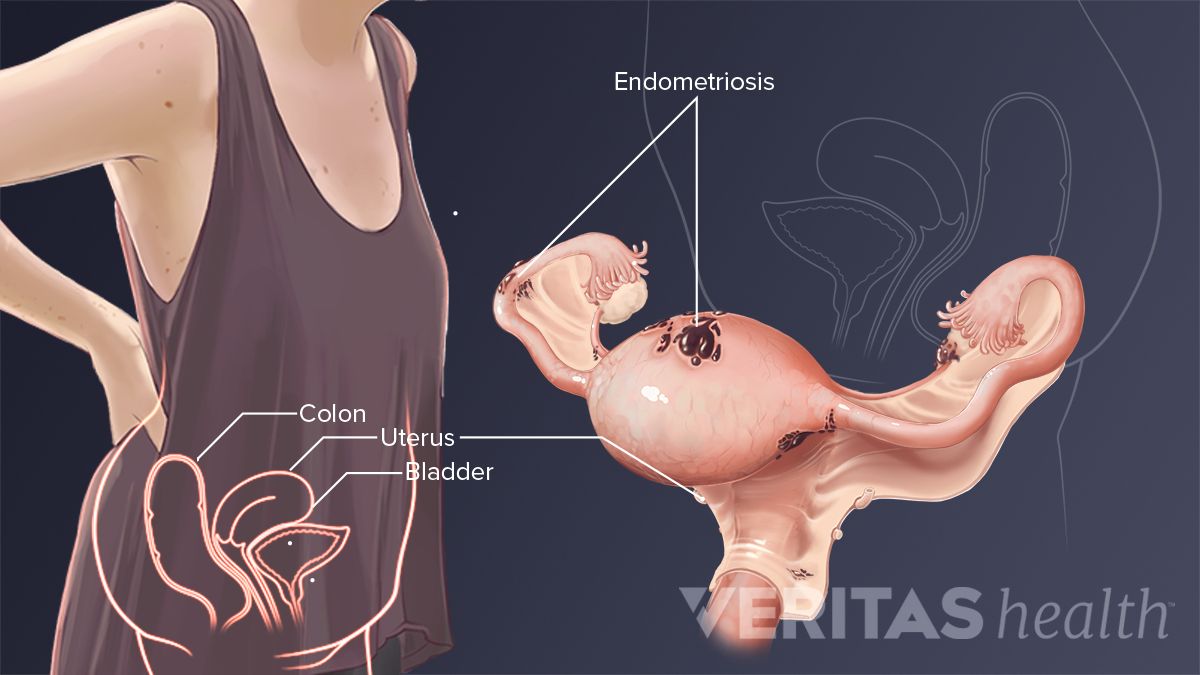 In side back right pain lower What Causes