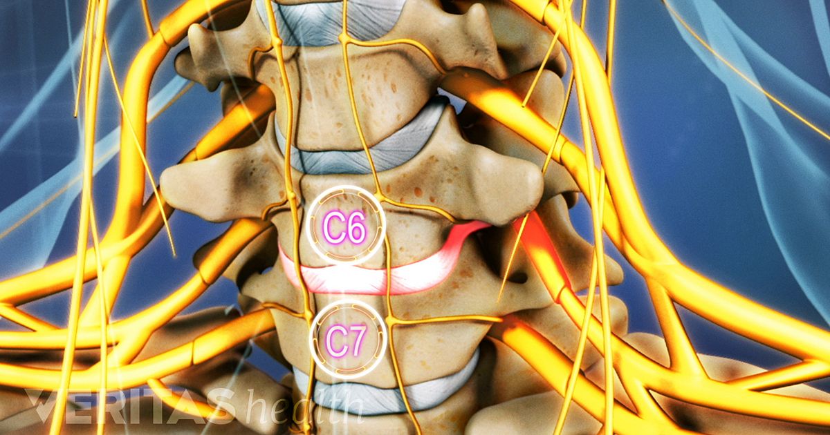 All about the C6-C7 Spinal Segment in the Neck