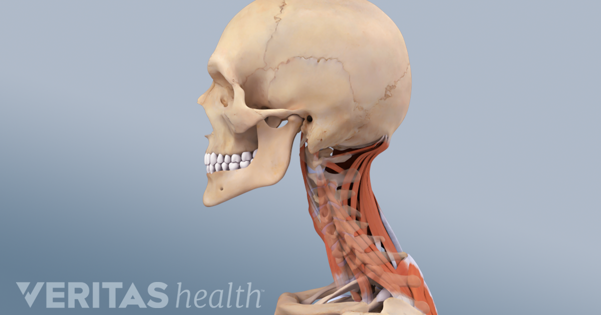 Cervicogenic Headache Causes And Risk Factors Cervicogenic Headache Causes And Risk Factors