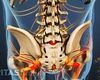 Isthmic Spondylolisthesis Video