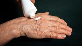 Video Reduce Arthritis Inflammation With This Homemade Cream