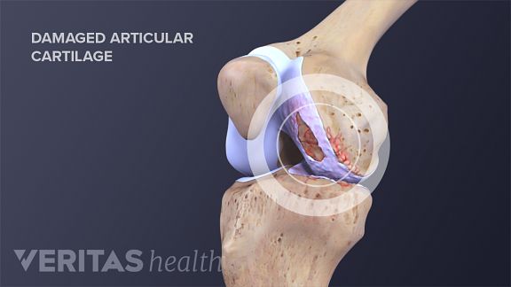 what is cartilage tissue