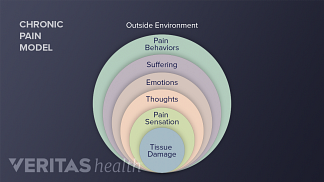 chronic pain model