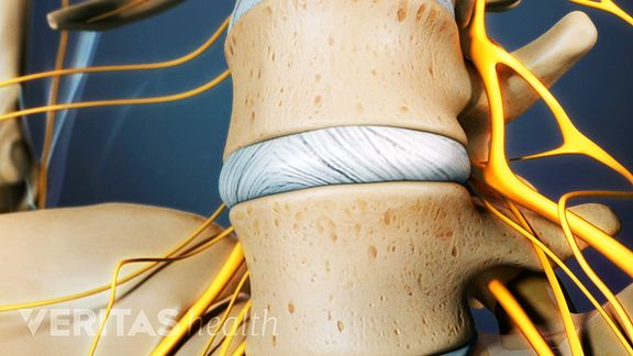 Early Treatments for Lower Back Pain Early Treatments for Lower Back Pain