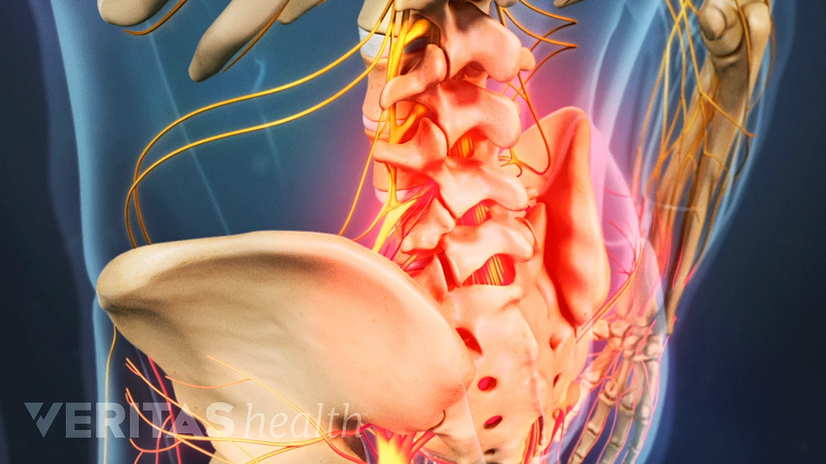 Got left flank pain in your #lowback? Or maybe #lowbackpain that wraps