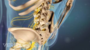 How Epidural Steroid Injections Work How Epidural Steroid Injections Work