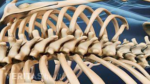 Vertebroplasty视频”loading=