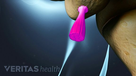 Neck Ligaments