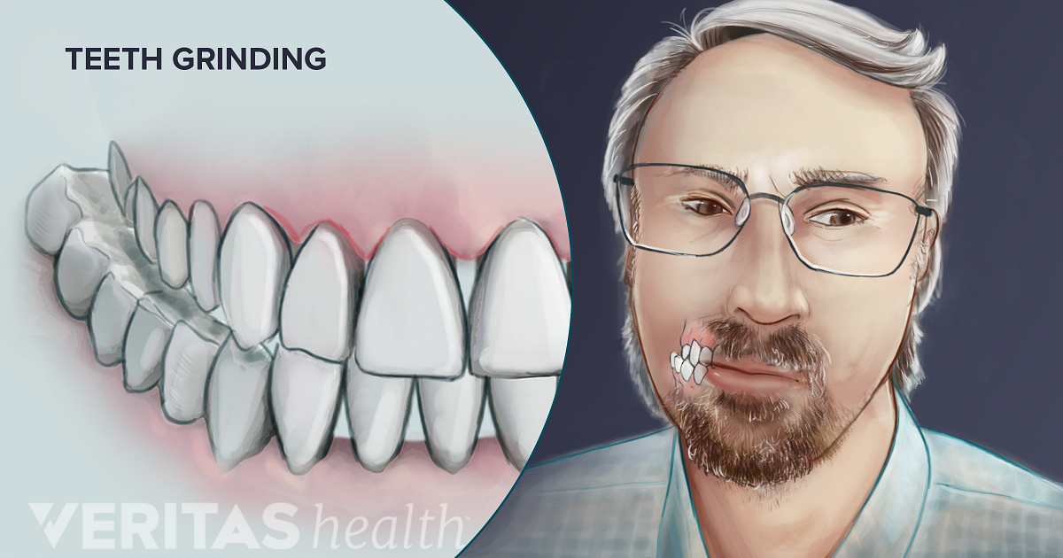 causes-and-risk-factors-of-temporomandibular-joint-tmj-disorders