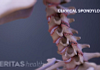 椎间盘退行性显示与脊髓型颈椎病