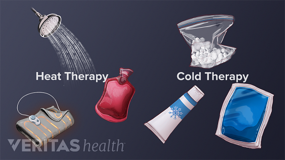 Applying Heat vs. Cold to an Arthritic 