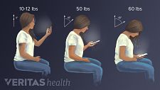 Illustration of the impact of looking down at your phone. 