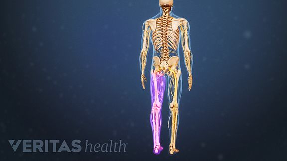 Nerve Problems in Leg