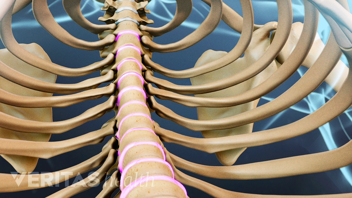 sælger dramatisk pære Can Rib Cramps and Pain Come from the Spine? | Spine-health