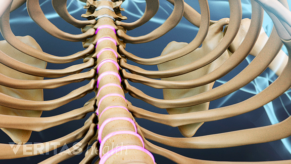 Can Rib Cramps and Pain Come from the Spine? - PSJC