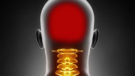 What Is Cervicogenic Headache