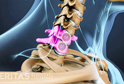 Cervical Spine Surgery