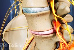 Tailbone Pain Causes