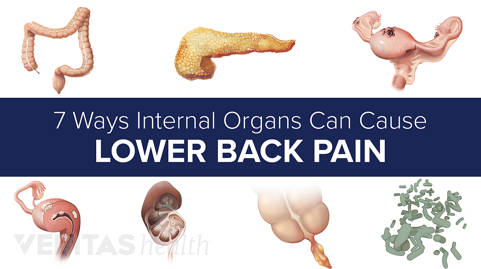 Slideshow: 7 Ways Internal Organs Can Cause Lower Back ...