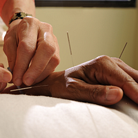 Acupuncturist inserting needles into a person's hand