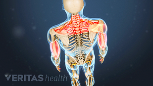 nerve compression at C-7 cervical spine level