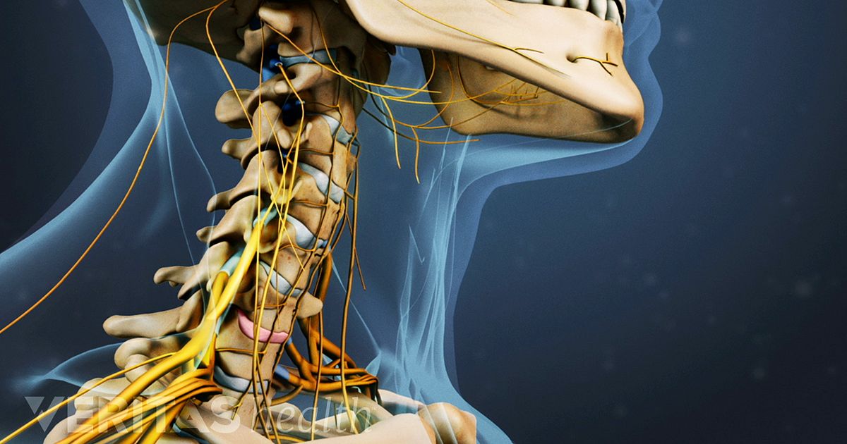 BRYAN Cervical Artificial Disc