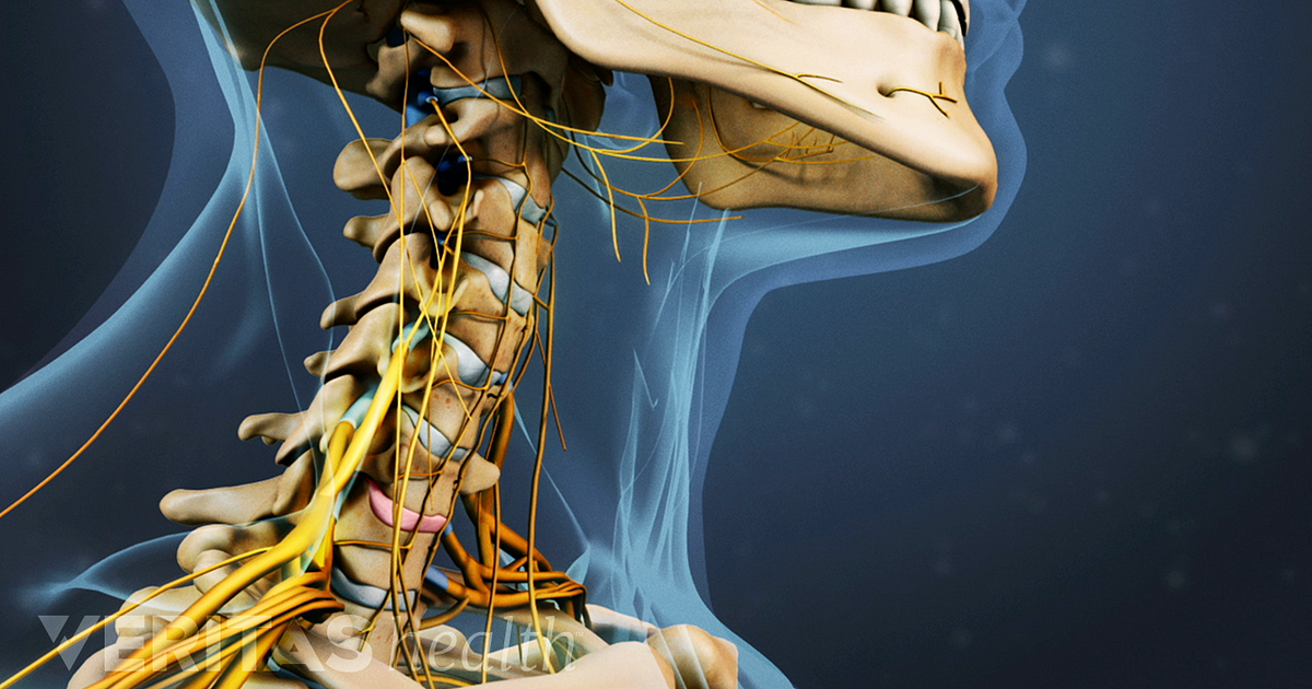 A Visual Guide to Anterior Cervical Discectomy and Fusion (ACDF) Surgery