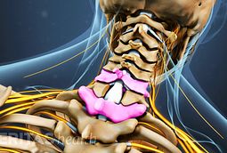 Spinous Process Definition | Back Pain and Neck Pain Medical Glossary