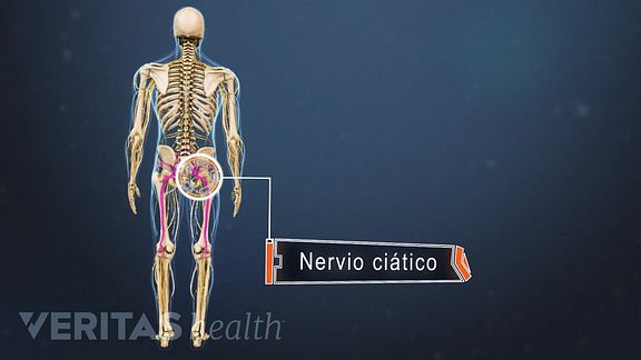 En externo de parte el pierna lado dolor la superior de la