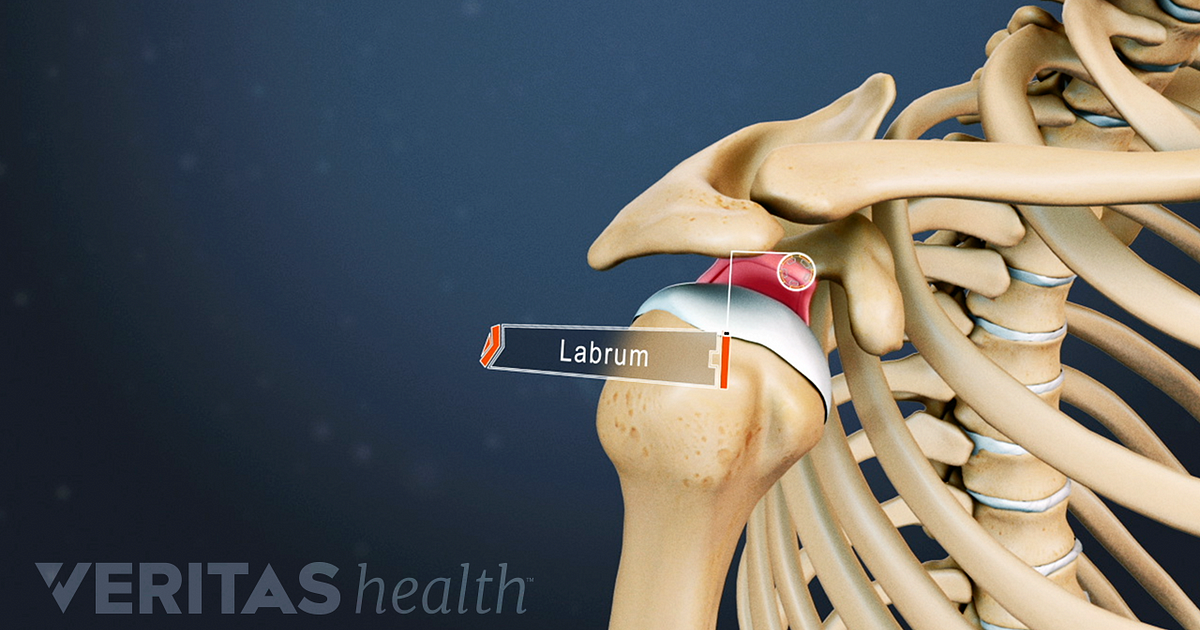 Labrum Definition | Defined by Arthritis-Health