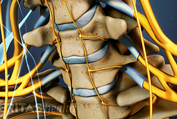 Cervical Artificial Disc Replacement Technologies