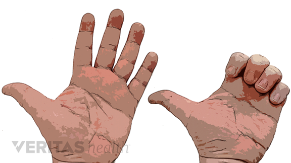 Knuckle Bend exercise