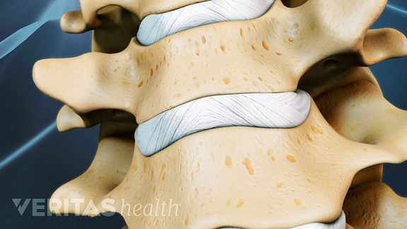 close up cervical discs