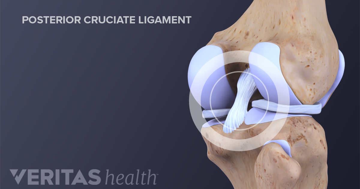 posterior-cruciate-ligament-pcl-definition-sports-injury-related