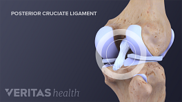 Anterior view of the posterior cruciate ligament