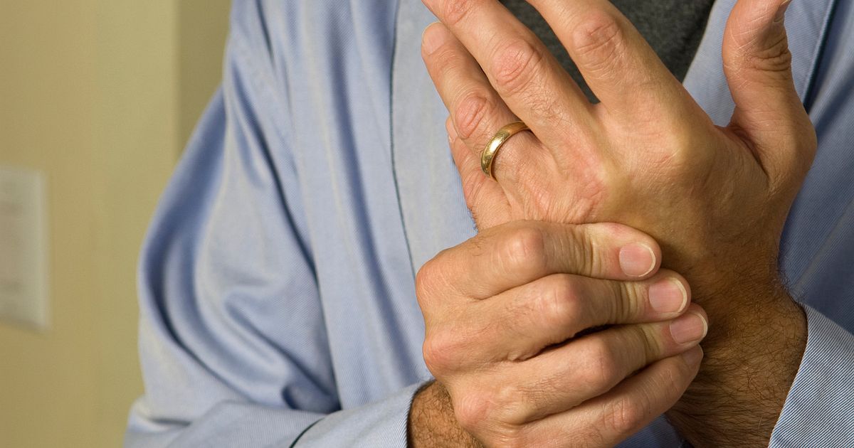 The Treat-to-Target Approach to Rheumatoid Arthritis
