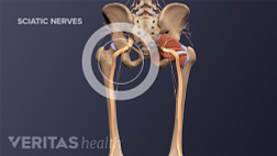 Posterior view of pelvis with sciatic nerve going down the left leg.